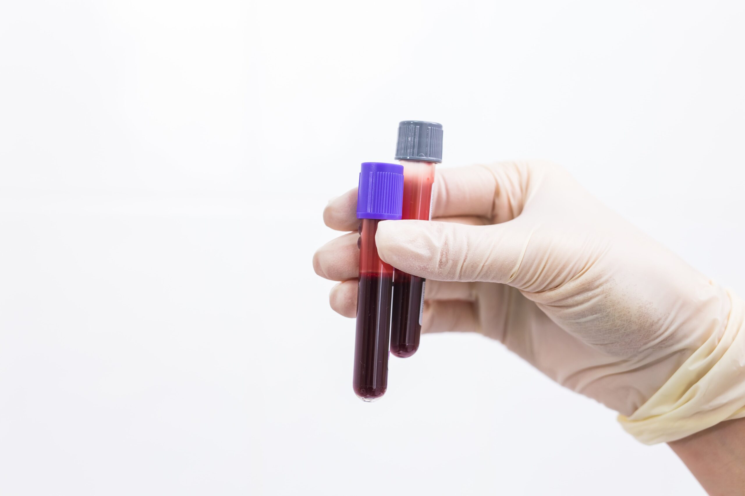 hand-holding-blood-tests-tubes-1-min